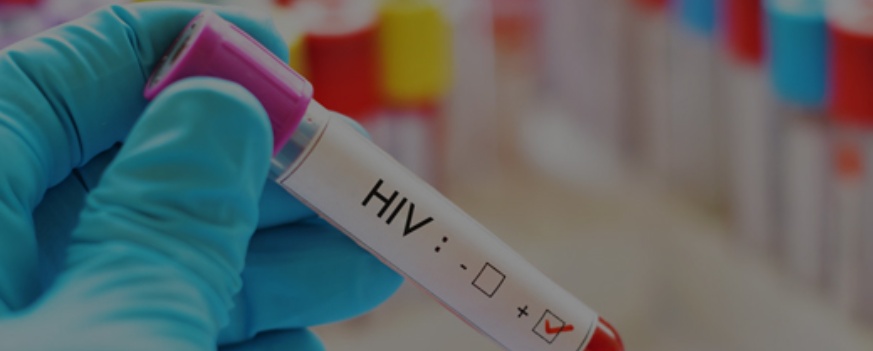 Annals of HIV Aids Research